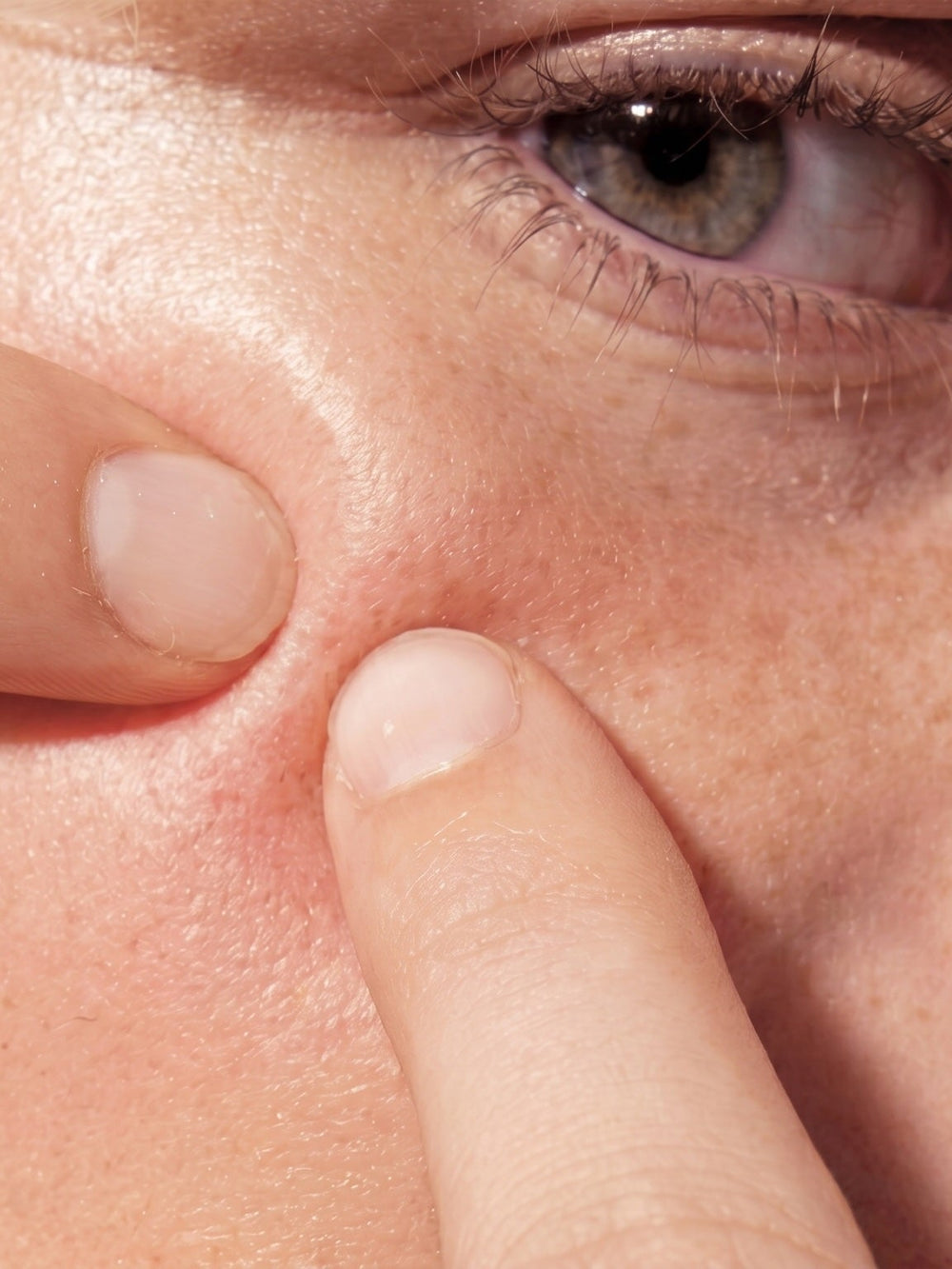 Hard Water and Your Skin: The Link to Dryness and Breakouts