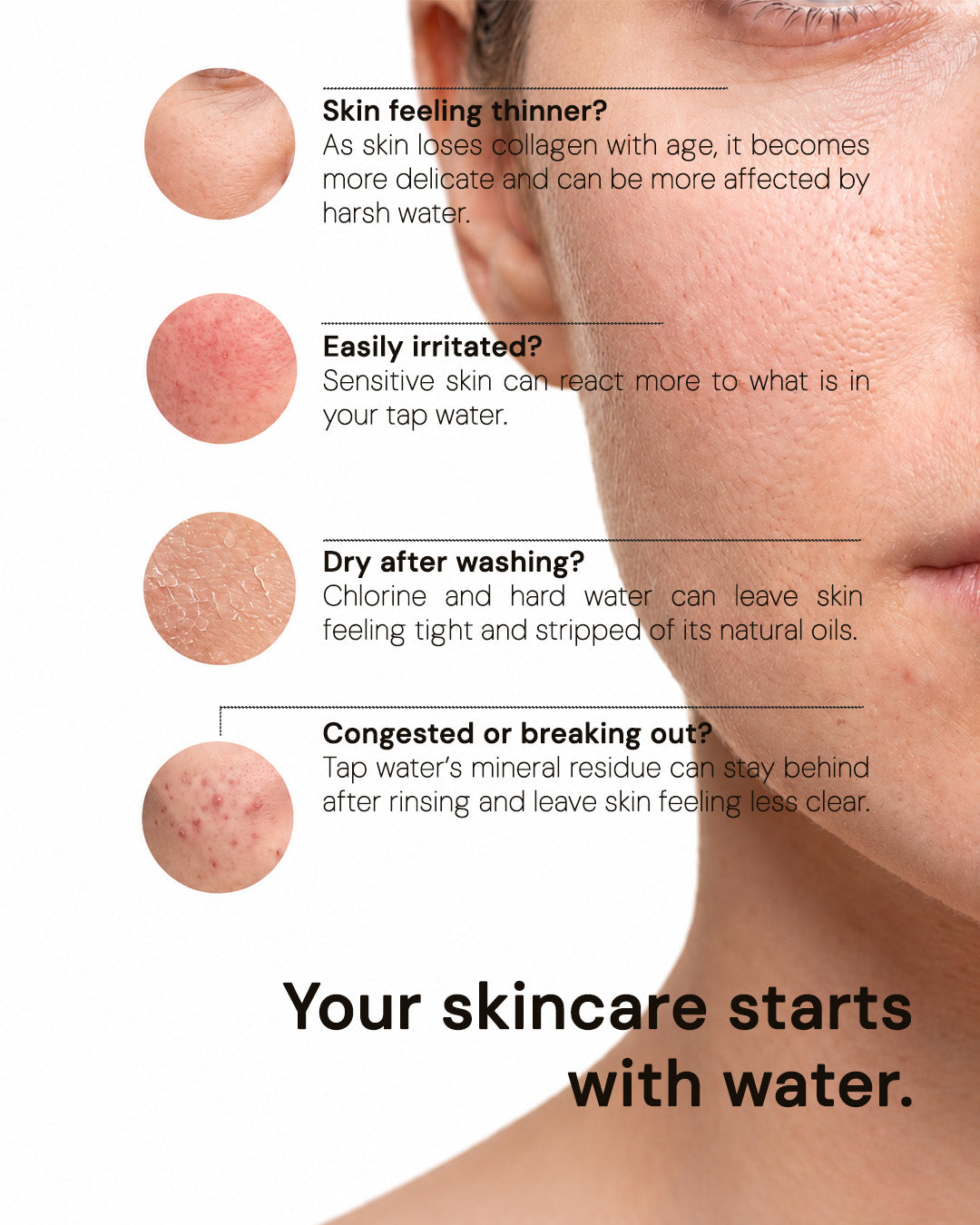 How brume filtered water helps skin
