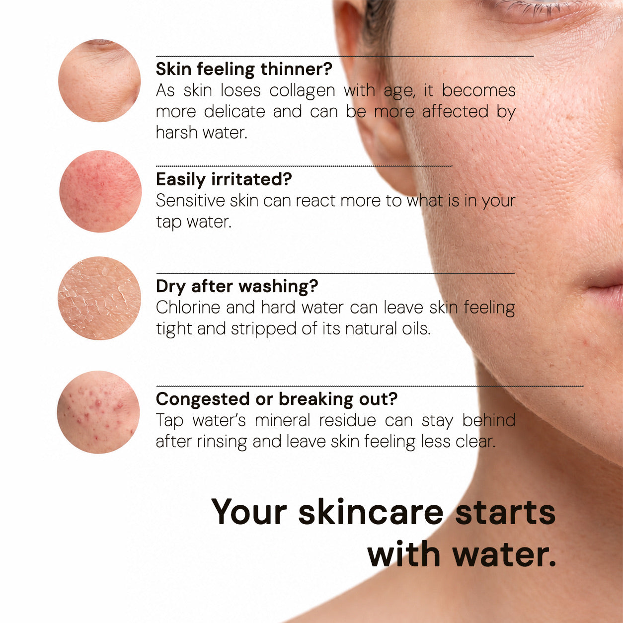 How brume filtered water helps skin