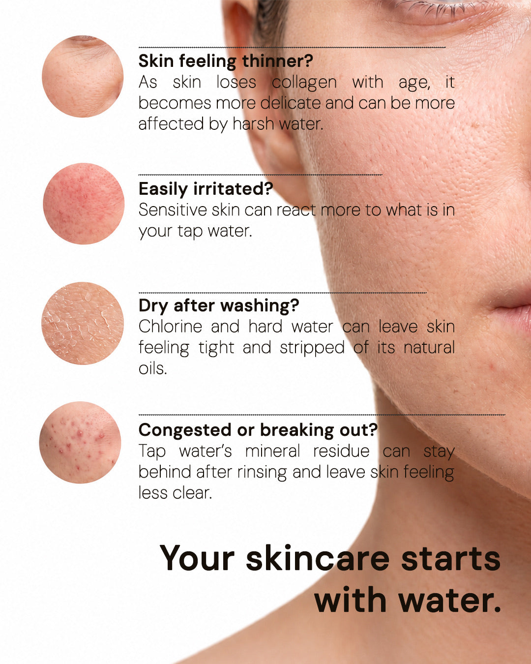 How brume filtered water helps skin