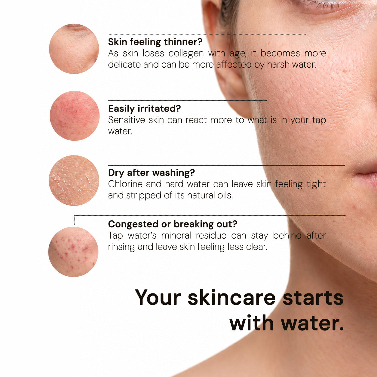 How brume filtered water helps skin
